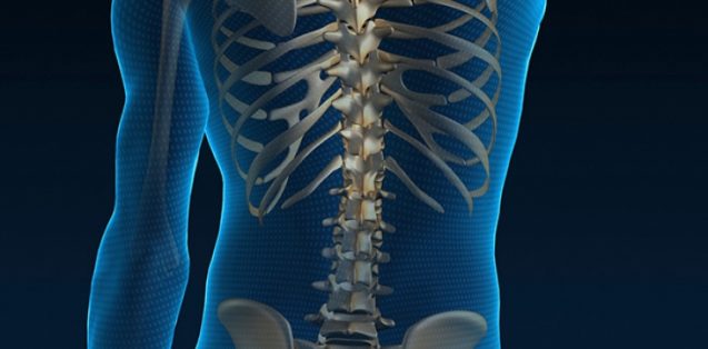 Presentation on SUcceSS Trial: SUrgery for Spinal Stenosis – Wednesday 24 May 2017